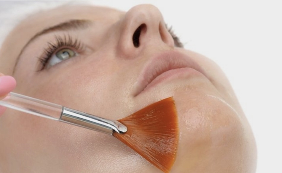 Sal-X 20 Salicylic Acid Peel