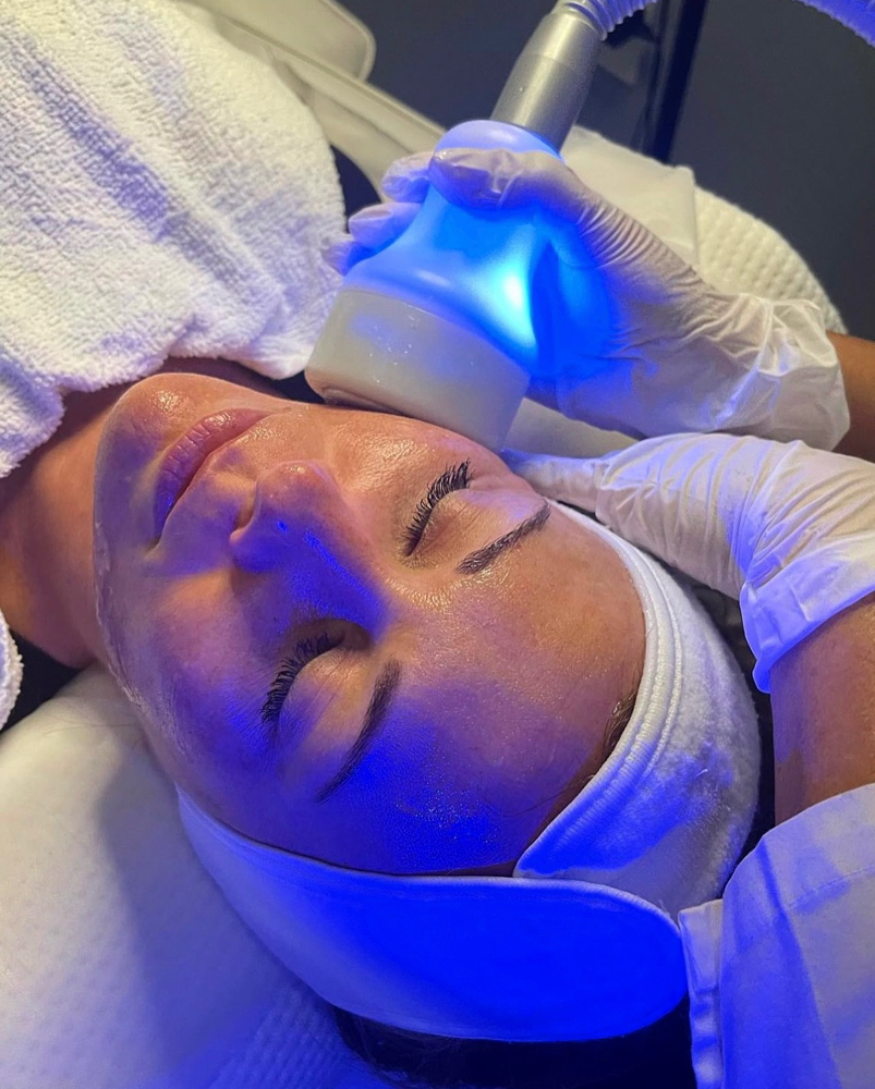 CryoFacial