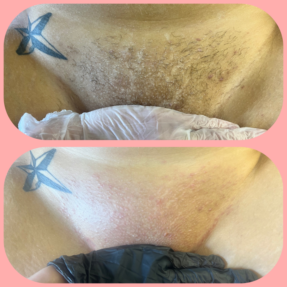 Brazilian Wax