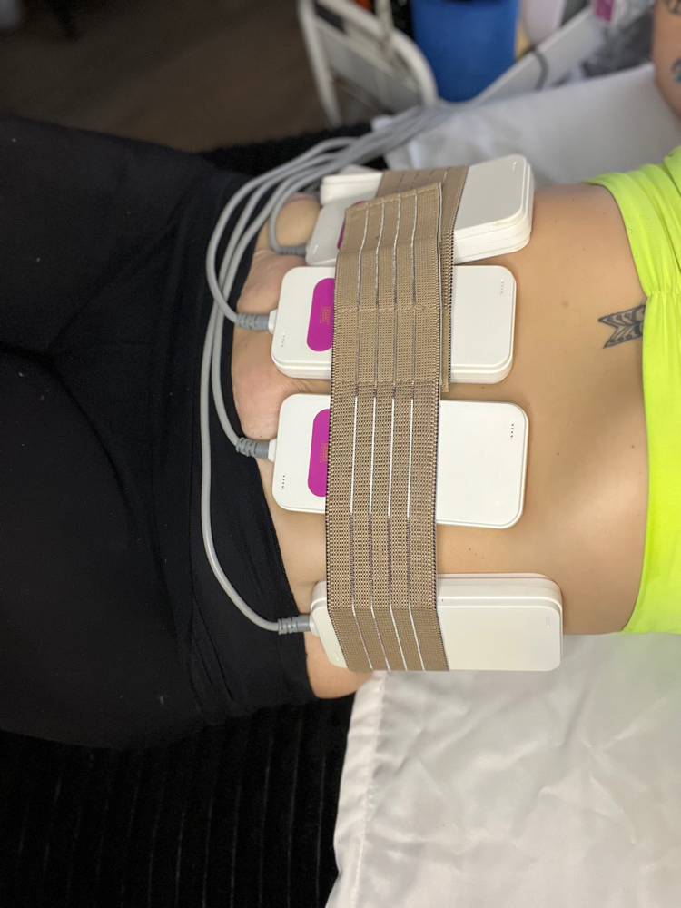 Model Fee Body Contouring