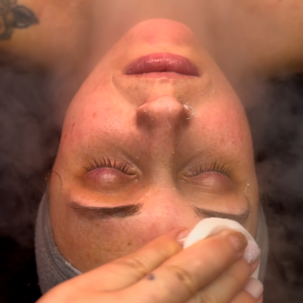 Barrier Repair Facial at Optimize Aesthetics & Wellness in Tewksbury, MA