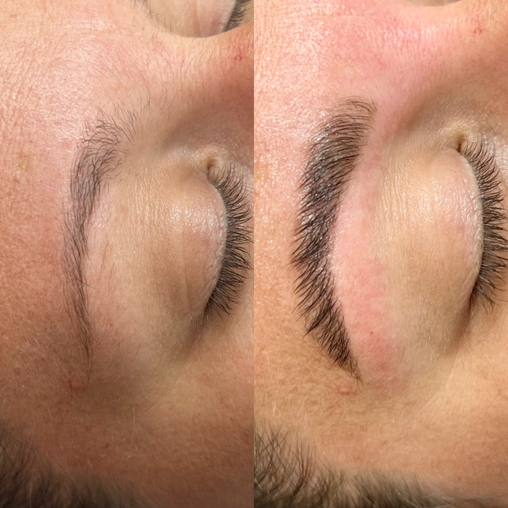 Brow Lamination