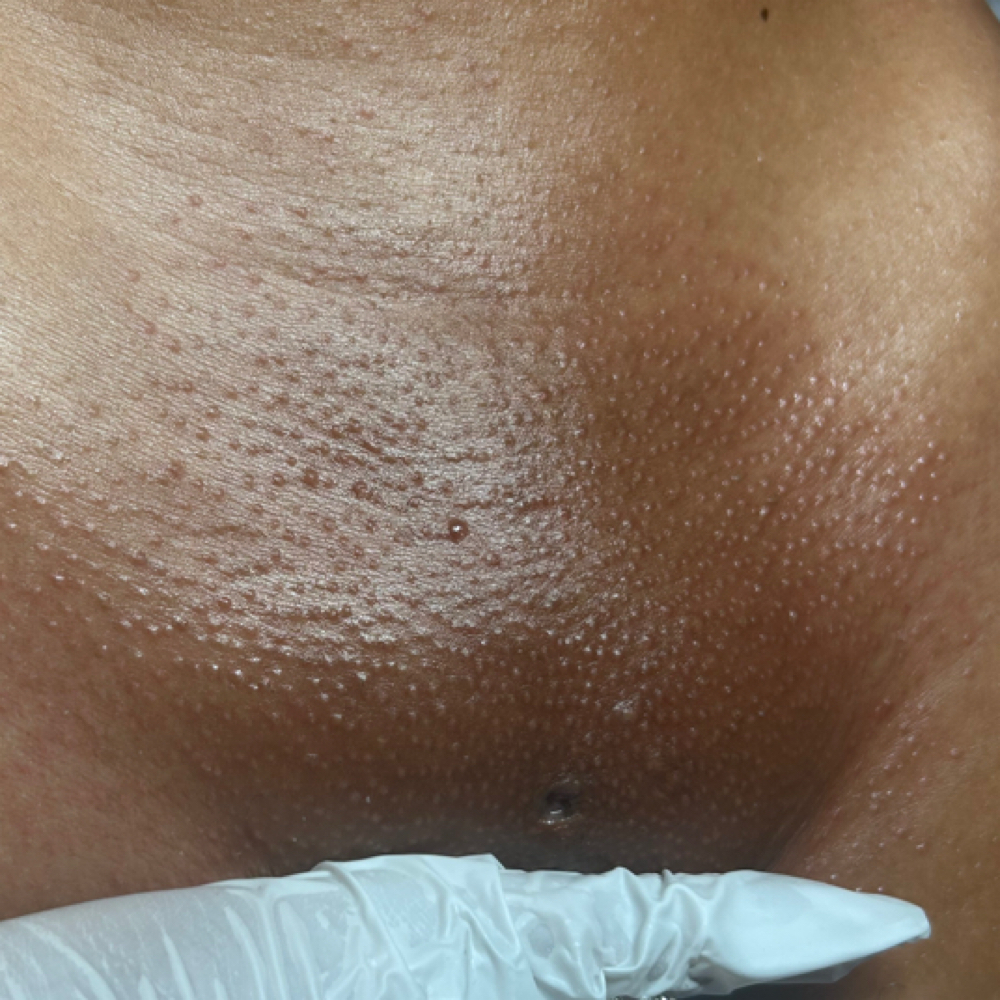 Brazilian Wax at Eshes Therapeutic Massage & Esthetics LLC in Huber Heights, OH