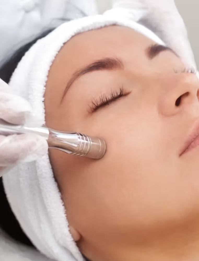 Microdermabrasion Facial