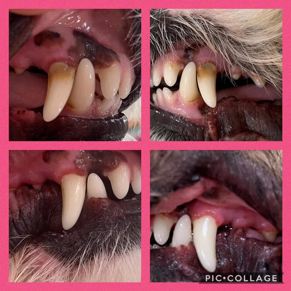 Deep Teeth Cleaning