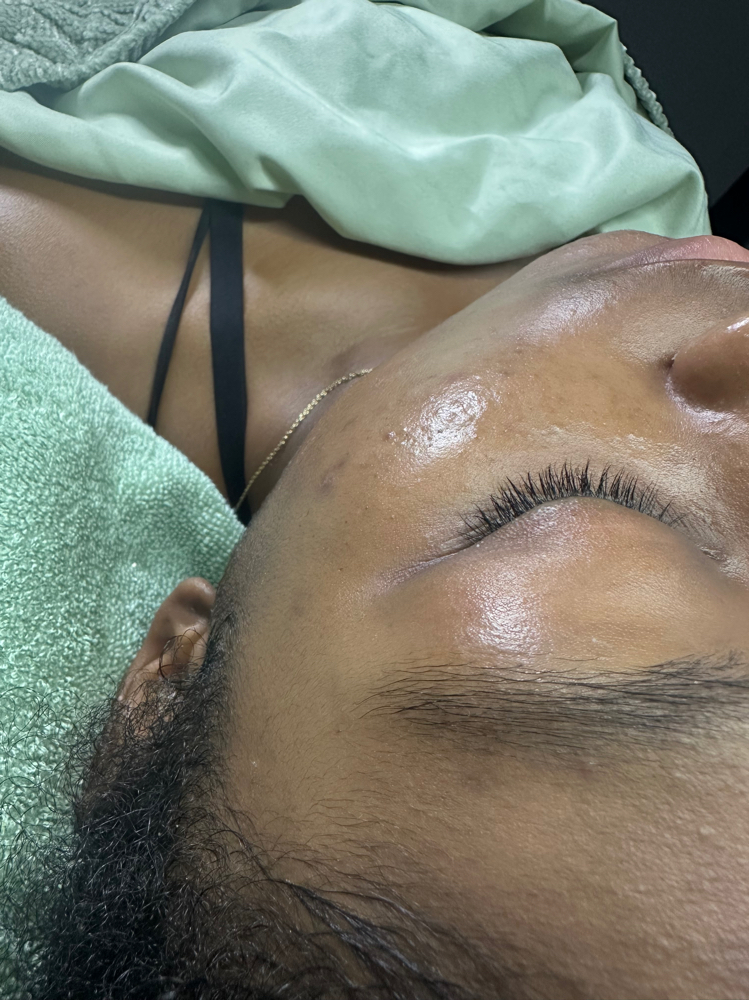 Corrective Skincare Treatments