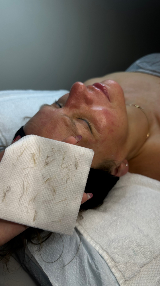 Dermaplane Facial