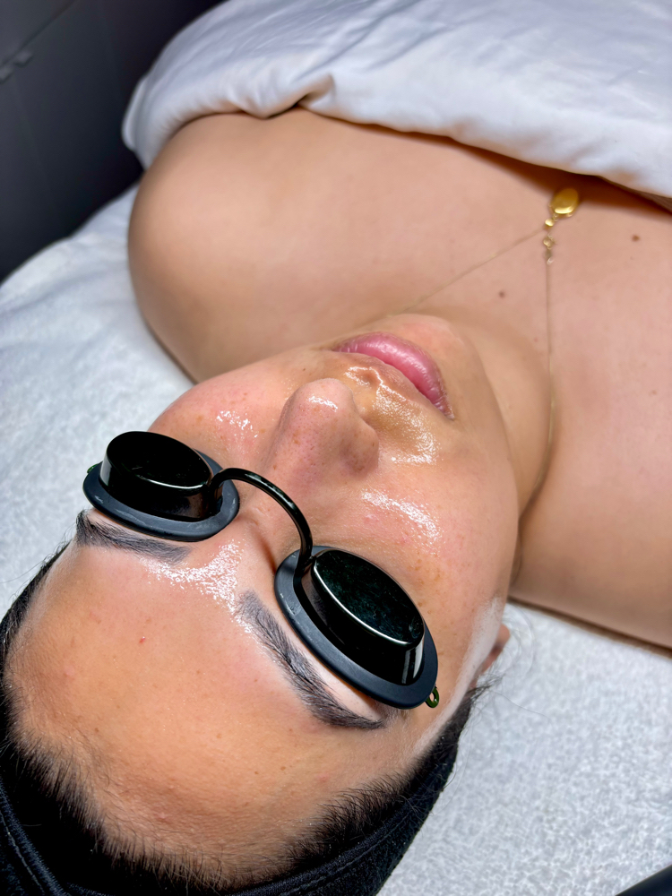 Dermaplane Glow Facial