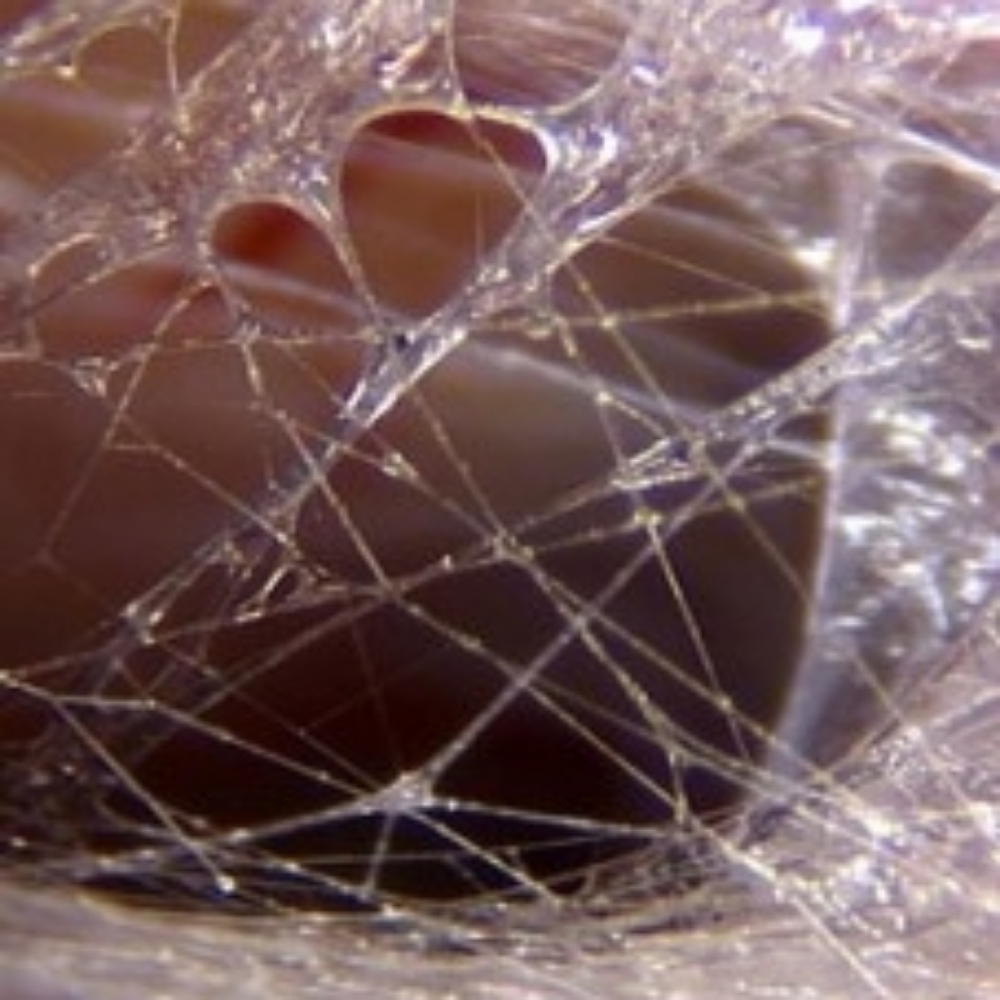 Myofascial Release (60-minutes) at The Healing Tree in Toledo, OH