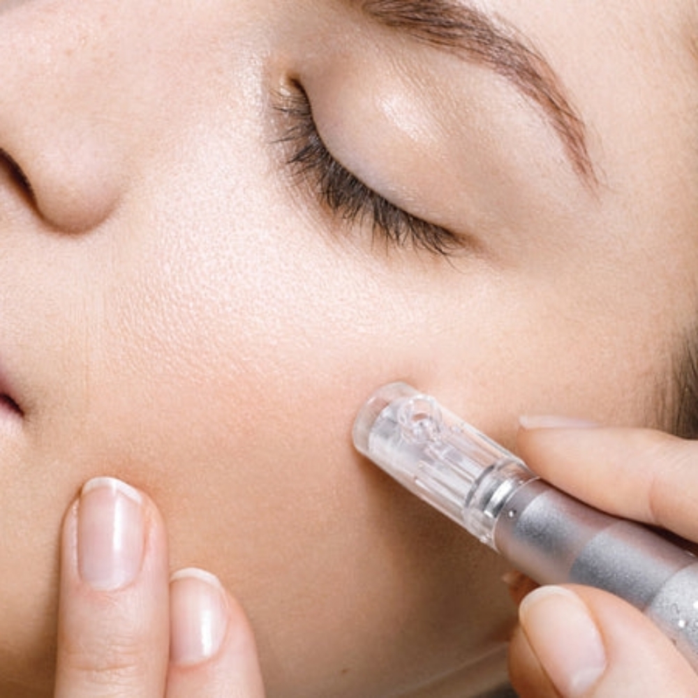 Lift and Glow Facial Treatment at Ziva Inner Beauty Spa in Cape Coral, FL