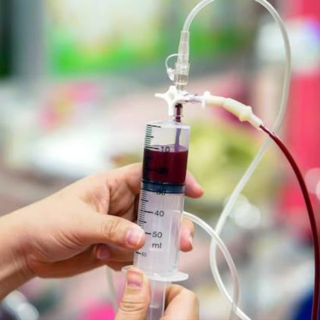 IV Iron Infusions Referral Only