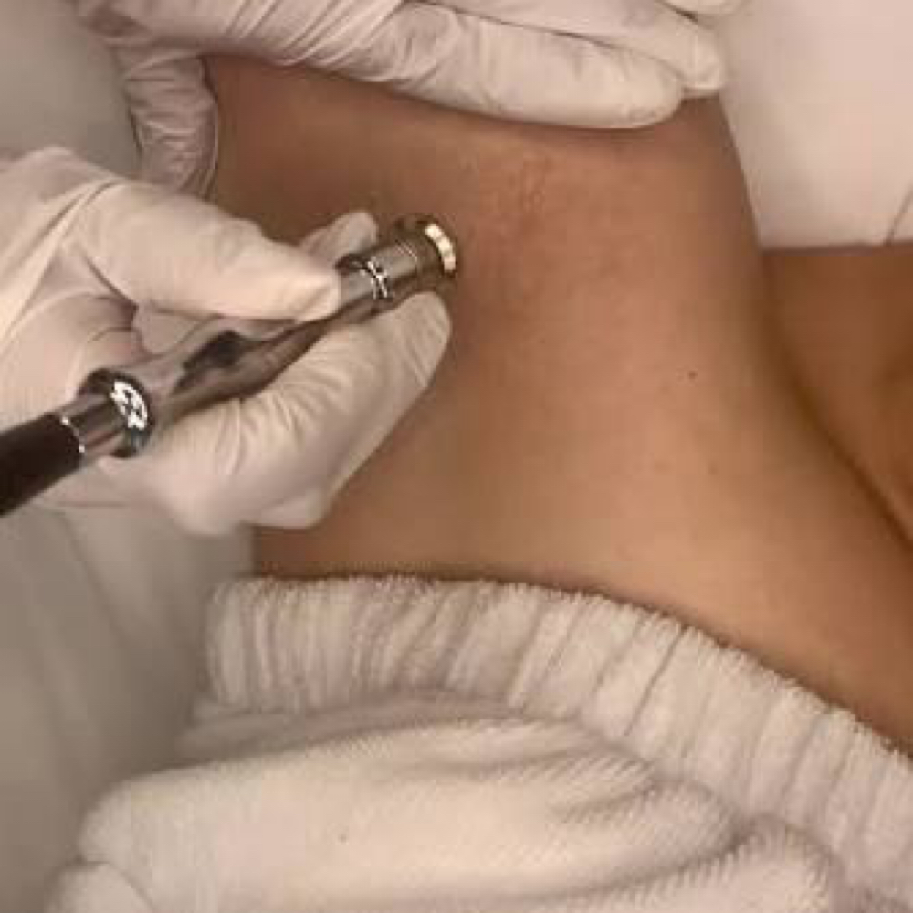 Brightening Underarm Treatment at Radiant Glow Skin Spa in Beaumont, TX