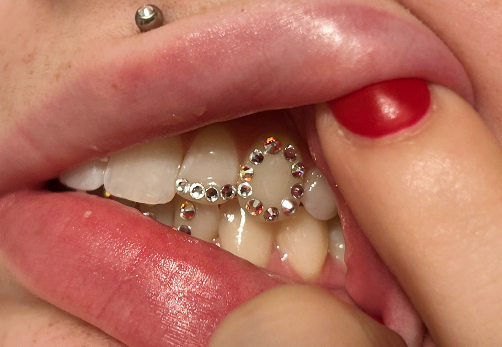 Window Tooth
