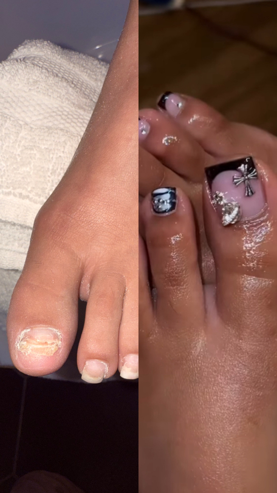 Acrylic Toenail Reconstruction at Nailz By Holliwood in los Angelos, CA