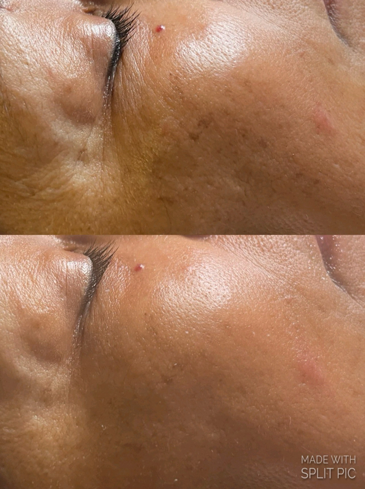 Green Power Peel