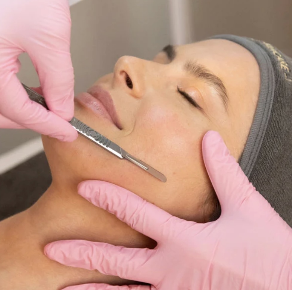 Dermaplaning
