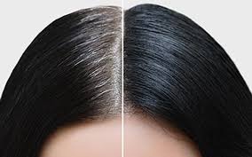 Root Touch Up