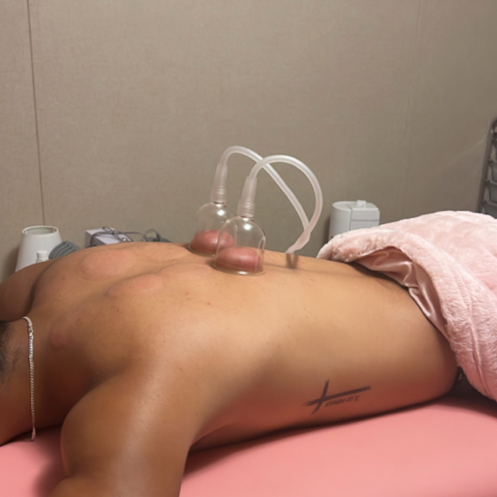 Cupping at BeauTIFFul Modifications in Natalia, TX