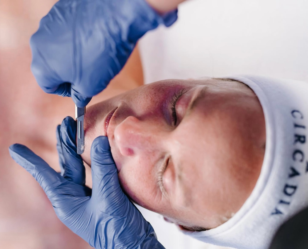 Dermaplane Facial