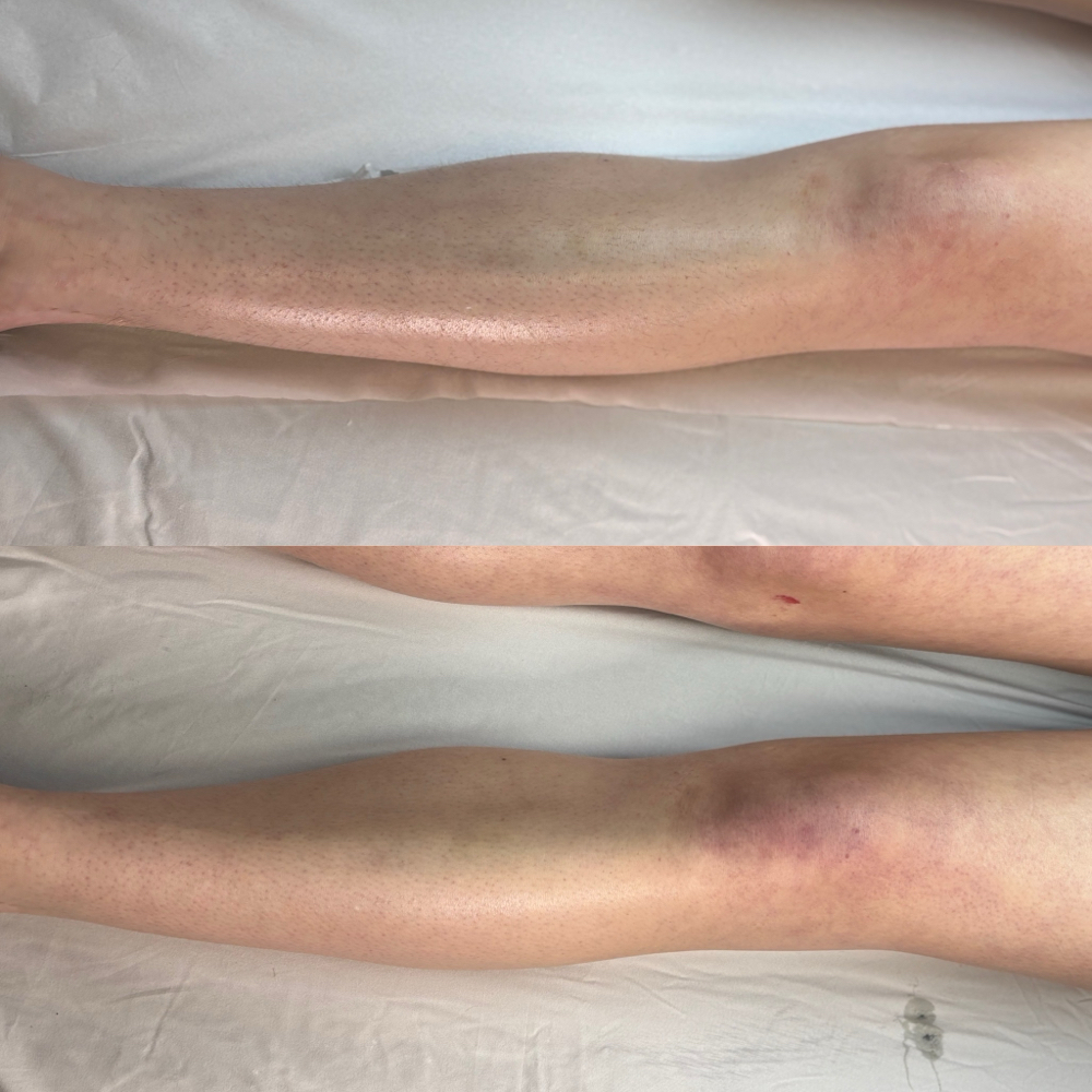Half Leg Wax