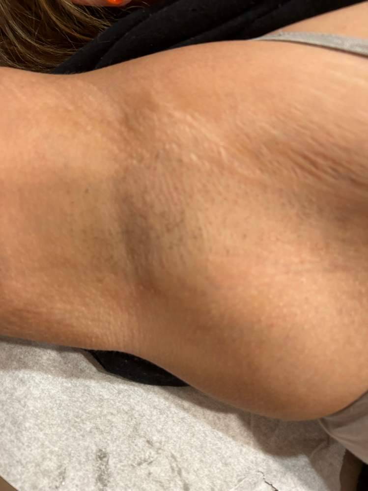 Wax Under Arms