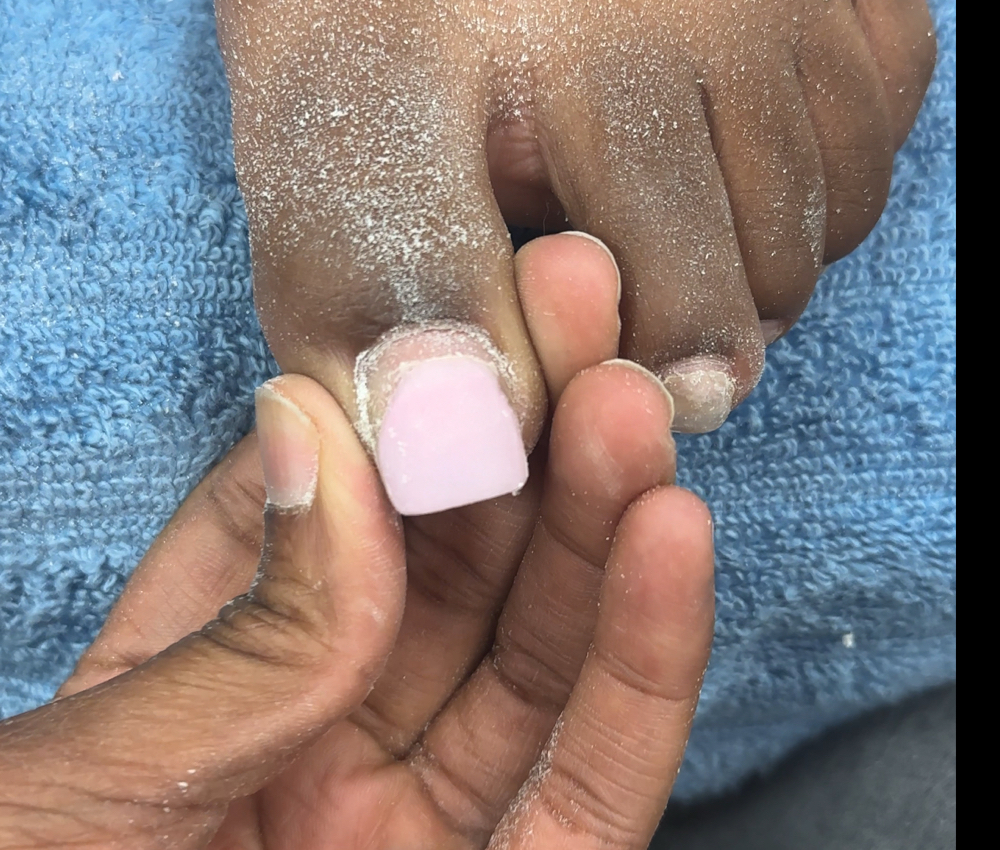 Big Toe Refill+Polish