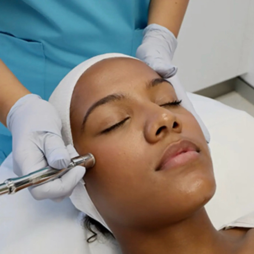 Microdermabrasion Facial at Rose Glow Aesthetics by Kayla in Lufkin, TX