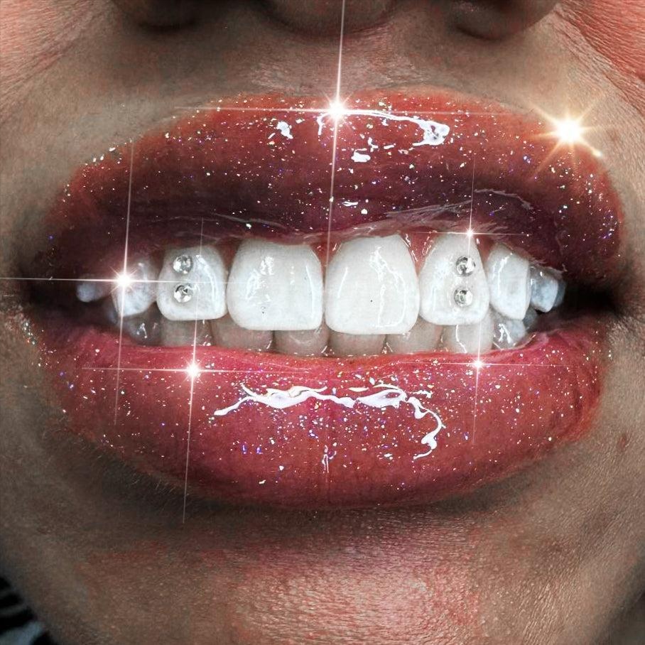 Combo Extreme Whitening + 1 Gem at Royal Blanc Smiles - Teeth Whitening and Tooth Gems in Charlotte, NC in Charlotte, NC