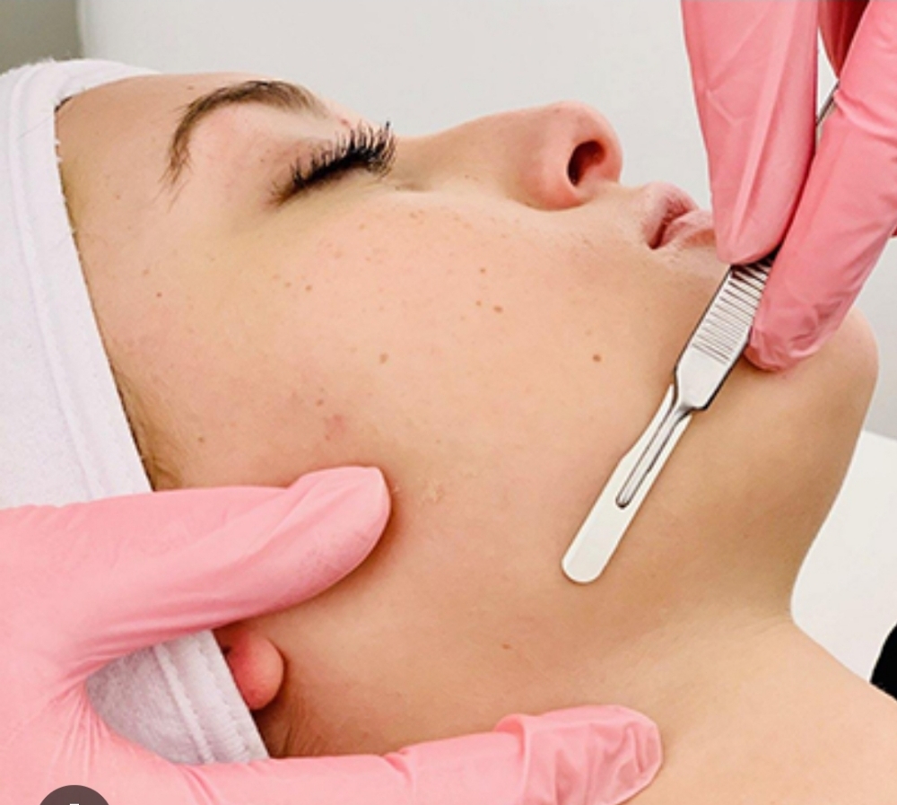 Dermaplaning Add On