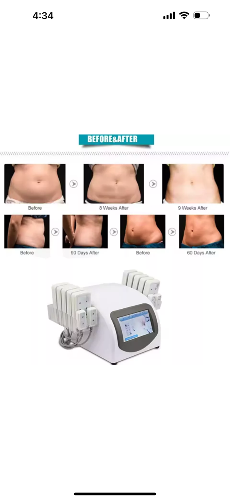 LaserLipo w/ Whole Body Vibration