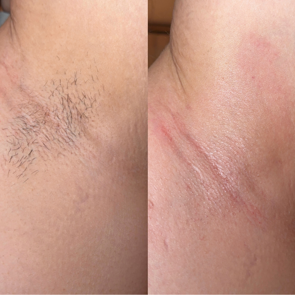 Underarm Wax at Studio Elysium in Watsonville, CA