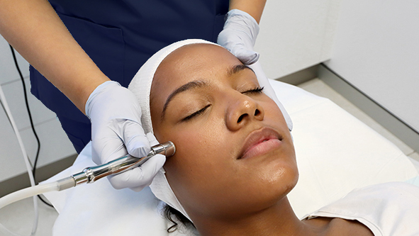 Microdermabrasion Add On