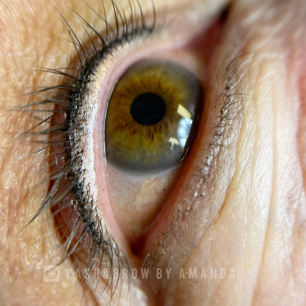 Eyelash Enhancement