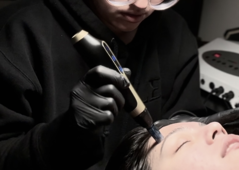 Needling Services