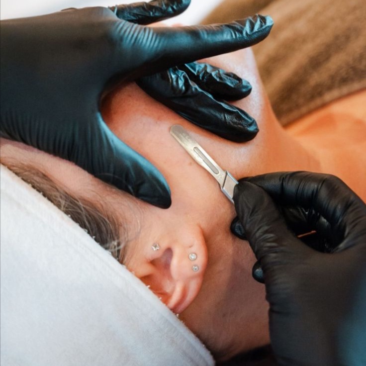 Express Dermaplane at Nyla Rose Skincare in Yuba City, CA