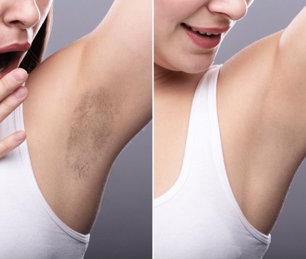 Underarms Wax