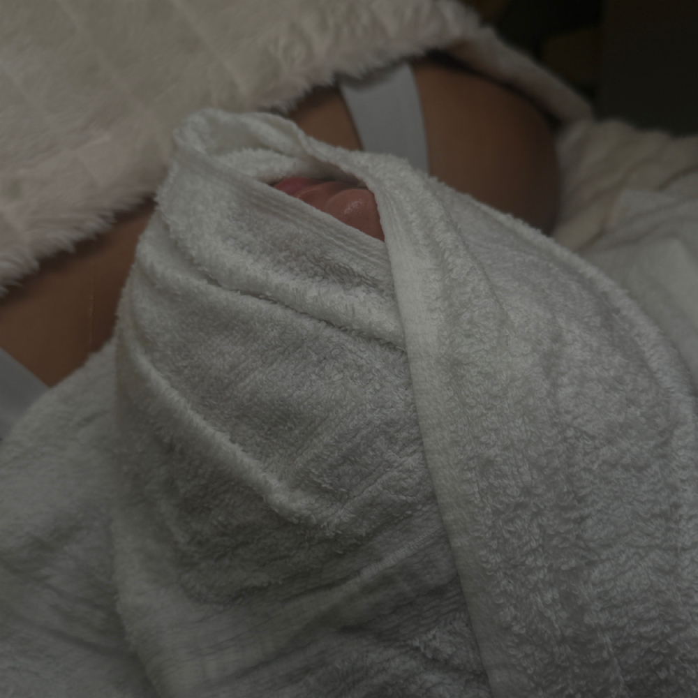 Soft reset facial at Raesthetics LLC in Fort Morgan, CO