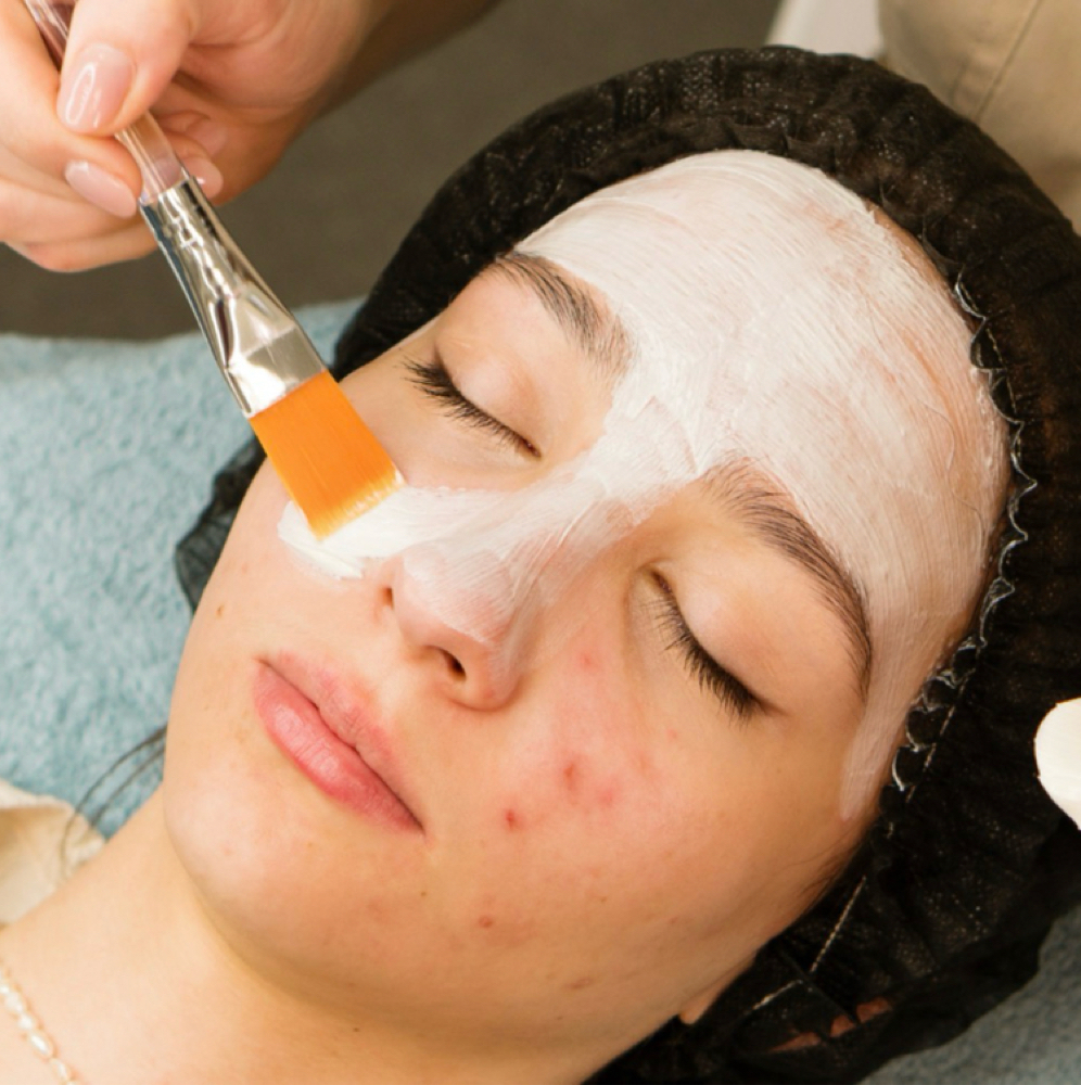 July/Aug - Teen Custom/Acne Facial at Lotus Divine Beauty & Wellness in Tracy, CA