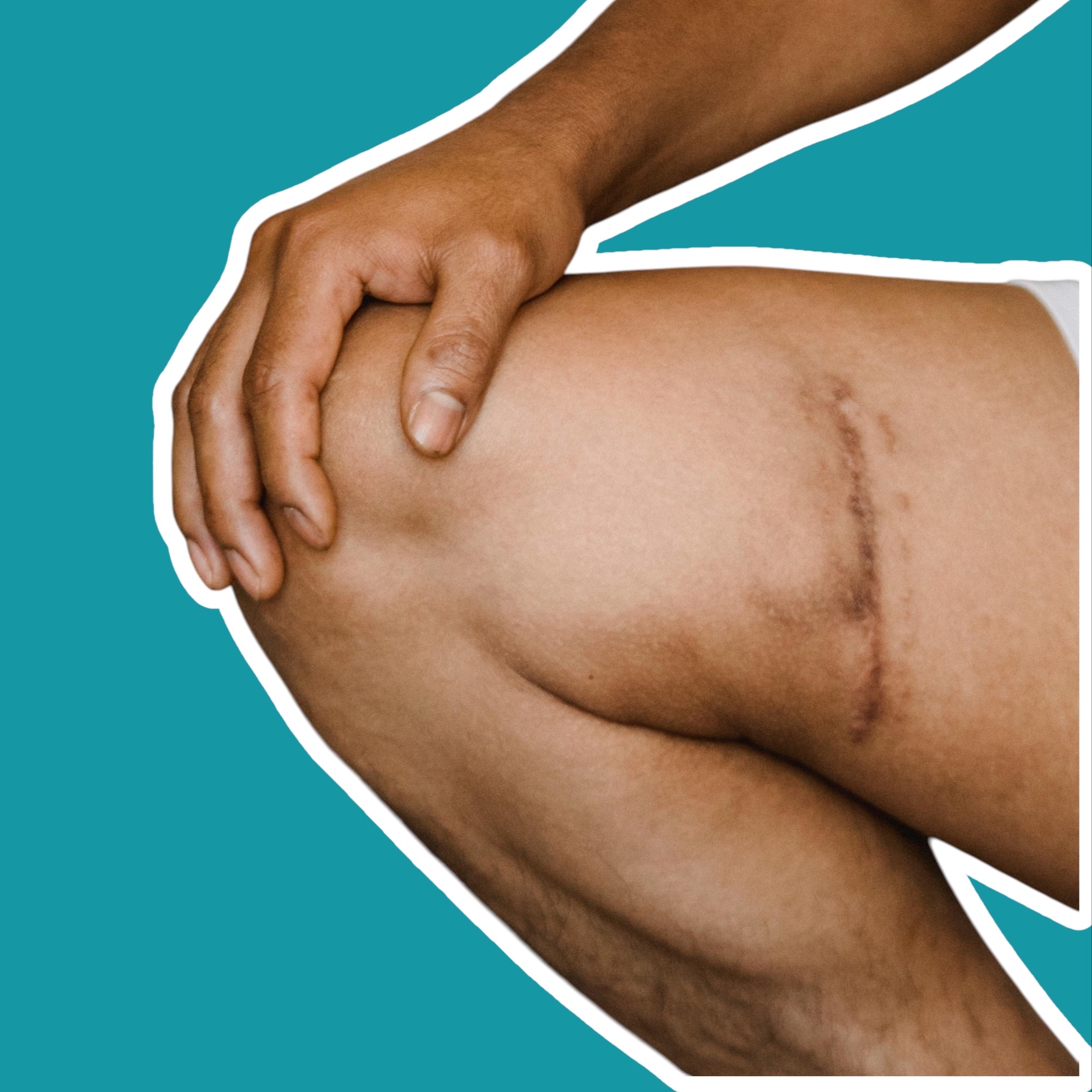 SCARS at Lines & Waves in Port Charlotte, FL