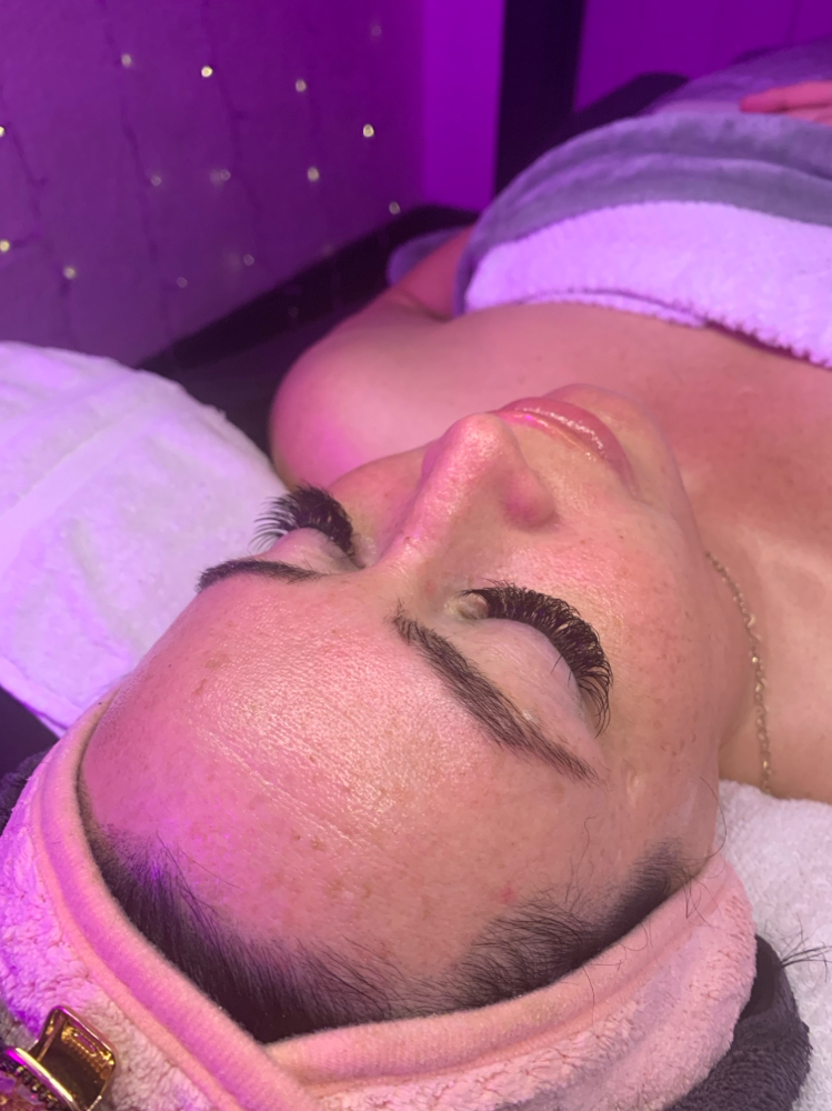 Dermaplane Facial