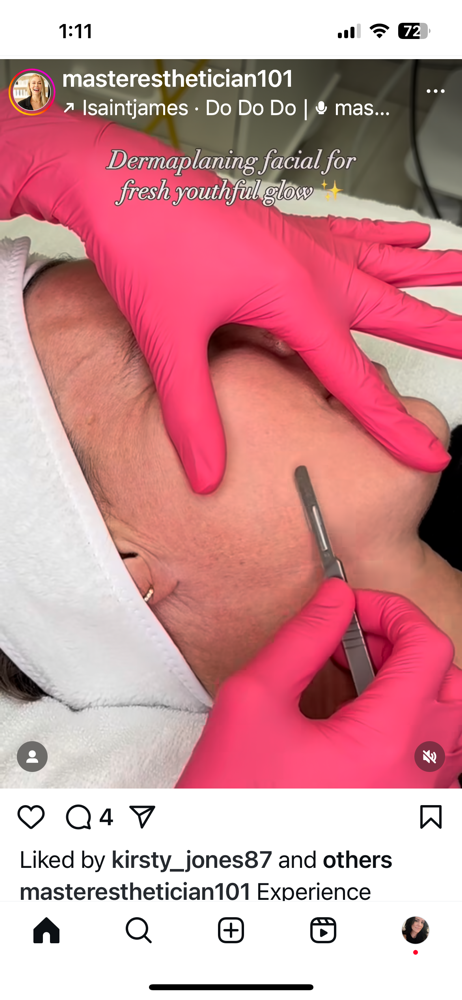Express Dermaplaning