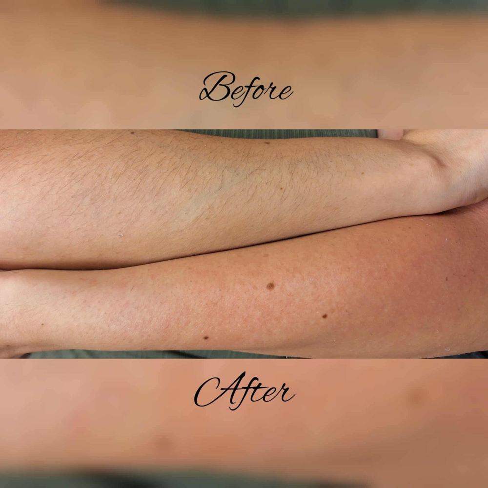 Full arm wax