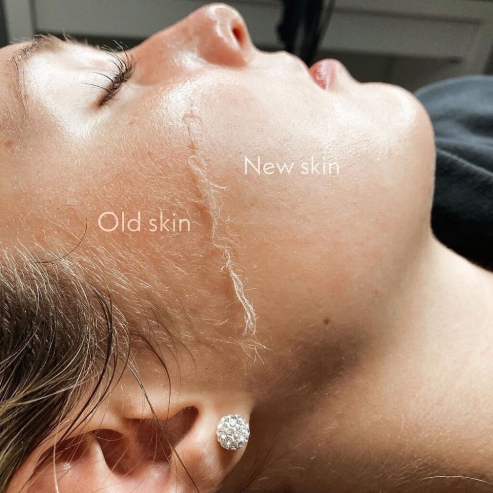 Express Dermaplaning Facial