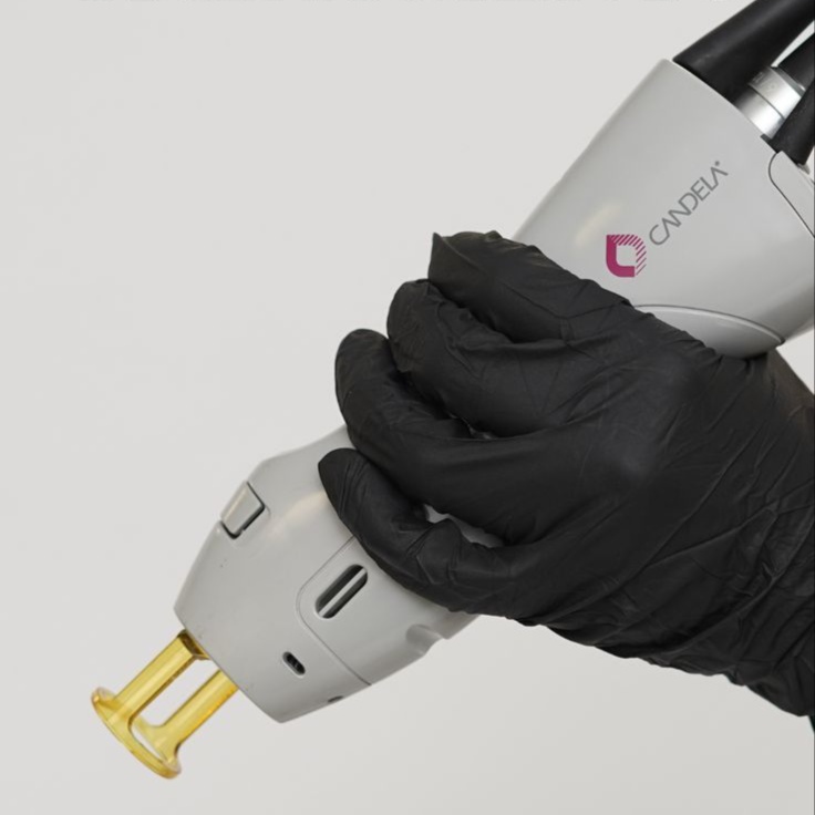 Front of Neck at Coco Aesthetics Medspa in Austin, TX