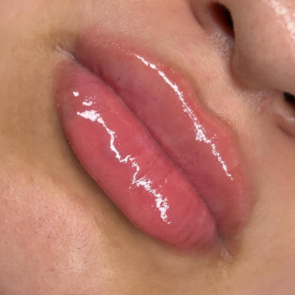 Pillow Pout 💋 | 1 mL at CurvSculpt in Denver, CO