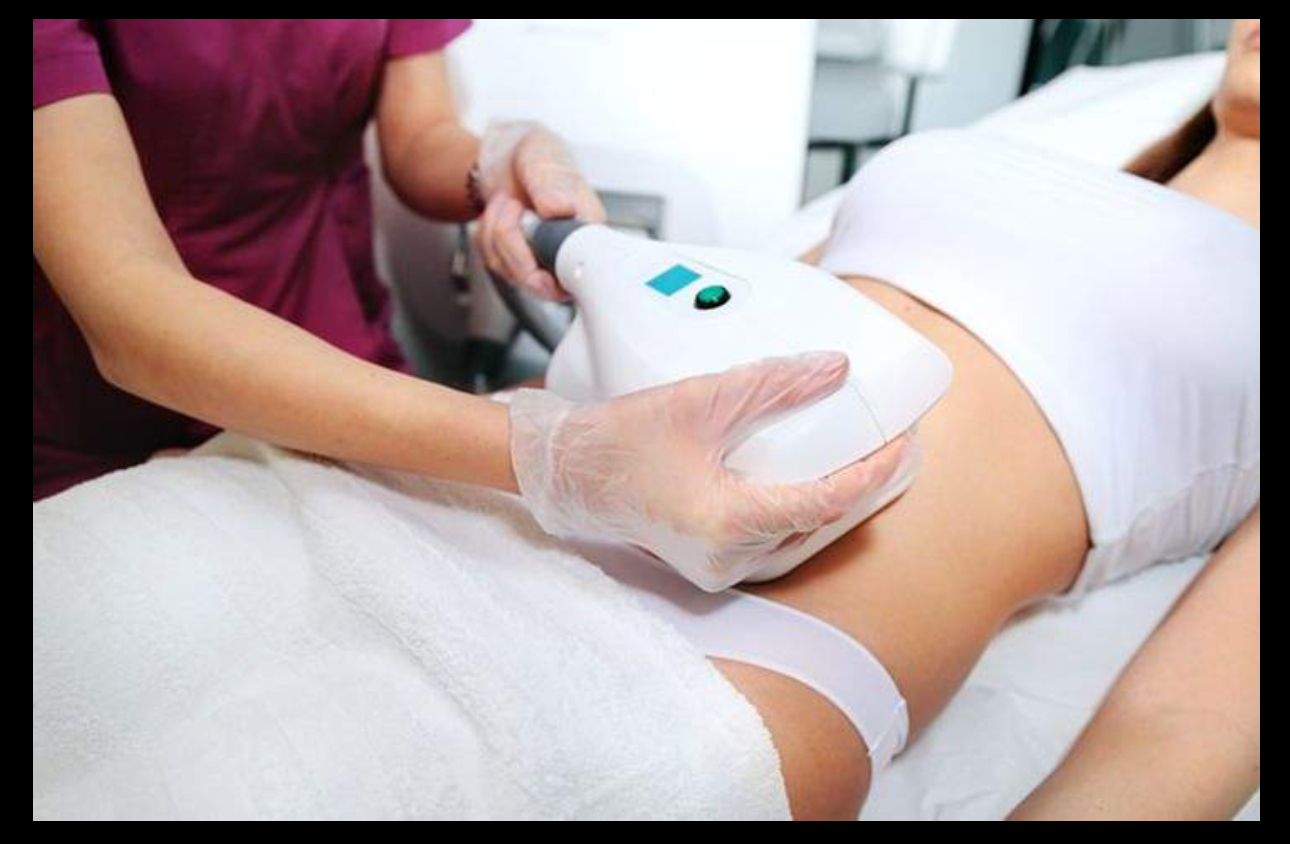 Bionexis Lite Pro (Per Area)