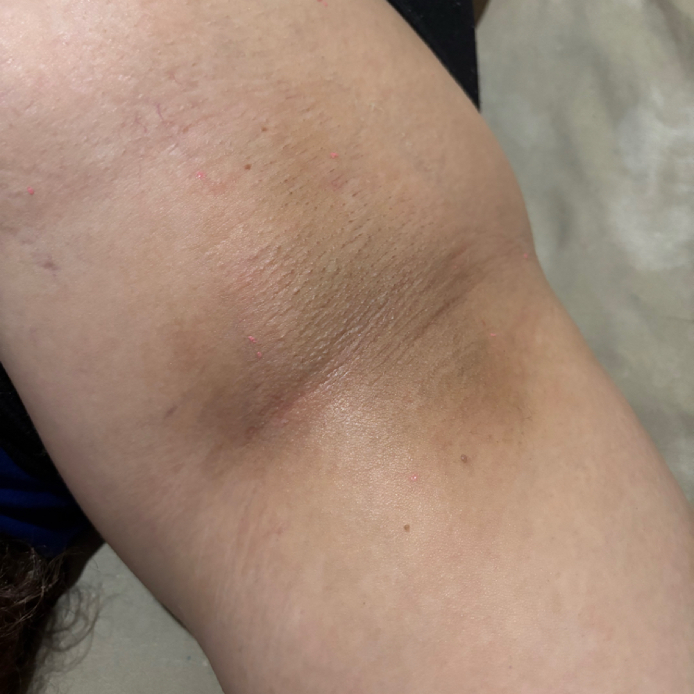 Under Arm Wax at Elegance Beauty Spa in Anderson, IN