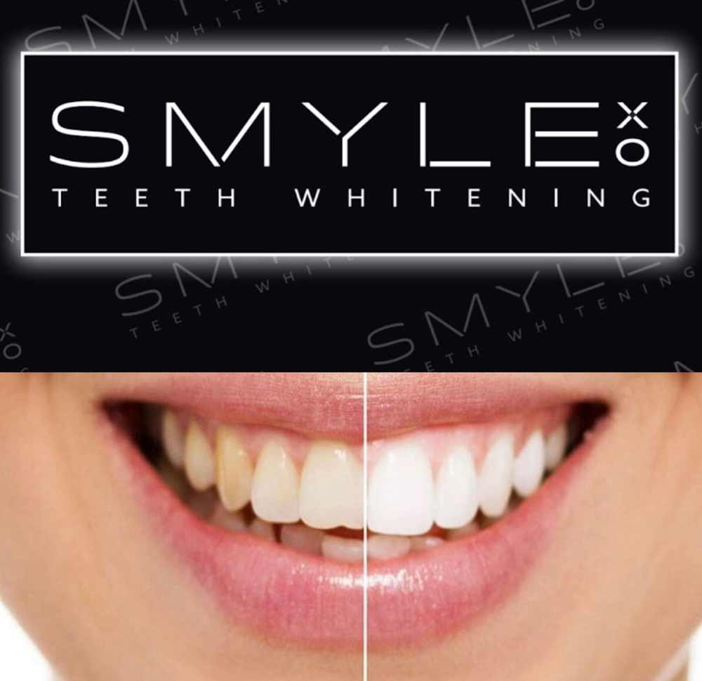 Smyle Xo Teeth Whitening
