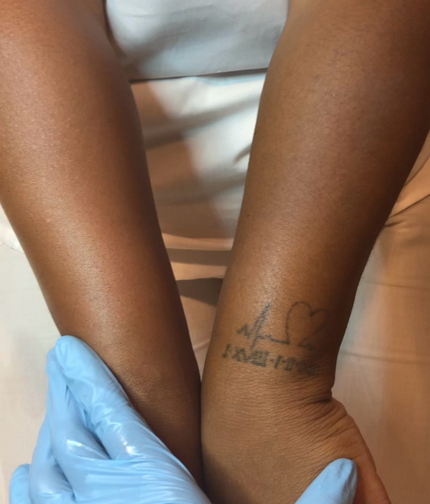 Full Arm Wax
