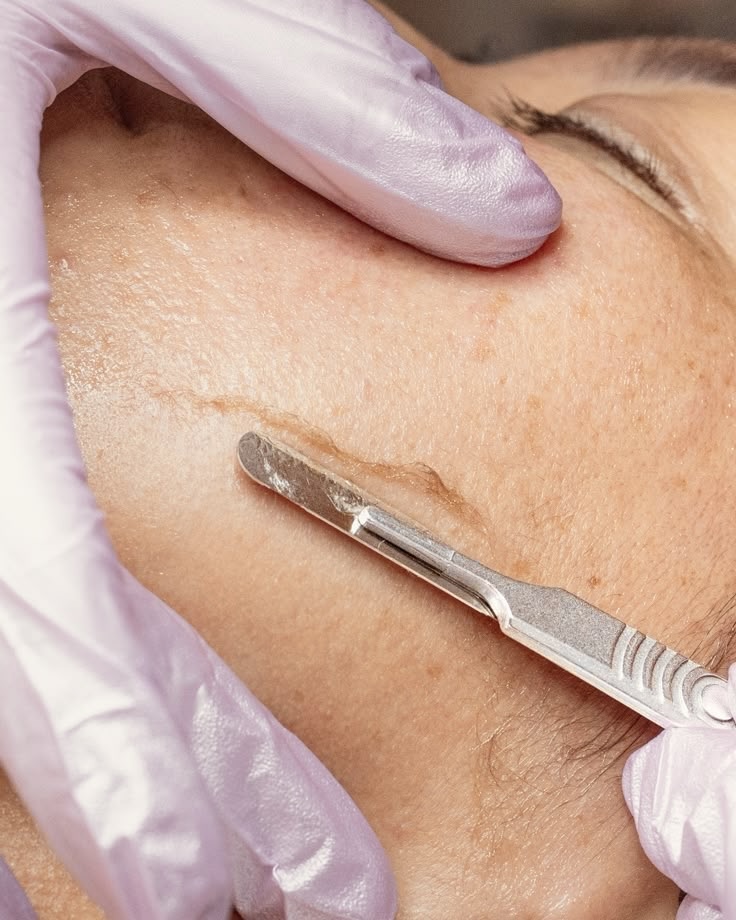 Dermaplaning (extra)